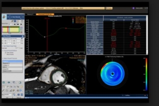 Philips IntelliSpace IX/LX Workstation for MR Cardiac
